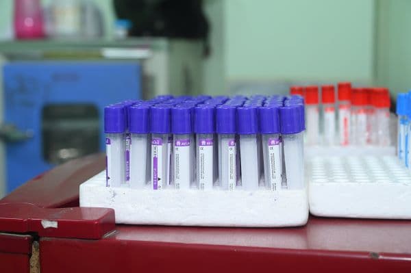 Lab